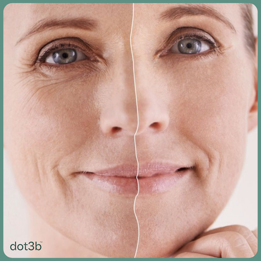 Gentle Retinol