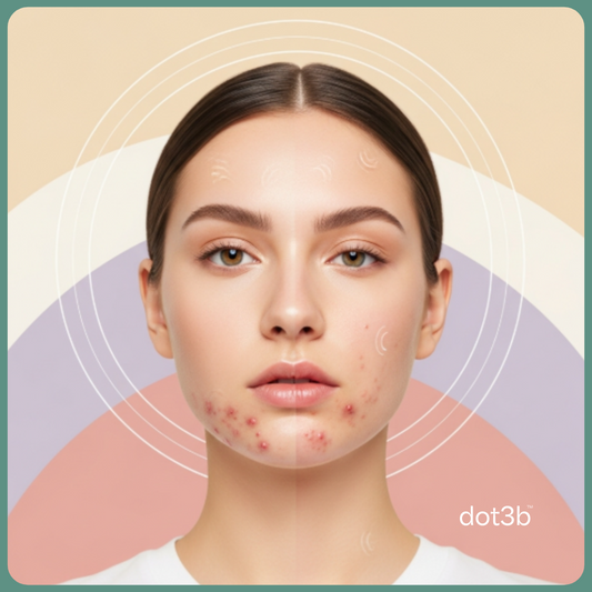 Hormonal Skin: The New Acne Type of 2025