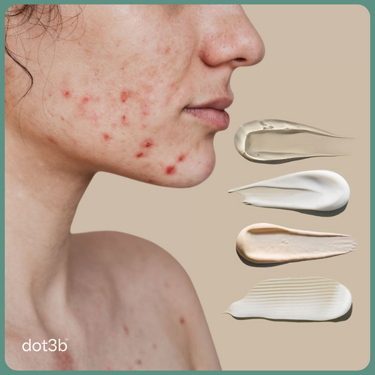 Ingredients to Avoid If You Have Acne-Prone Skin