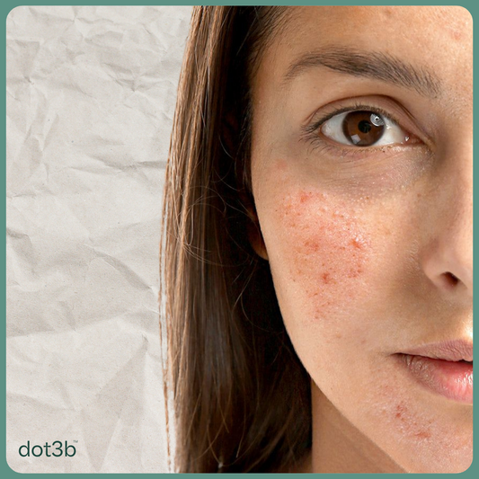 Sensitive Skin Savior