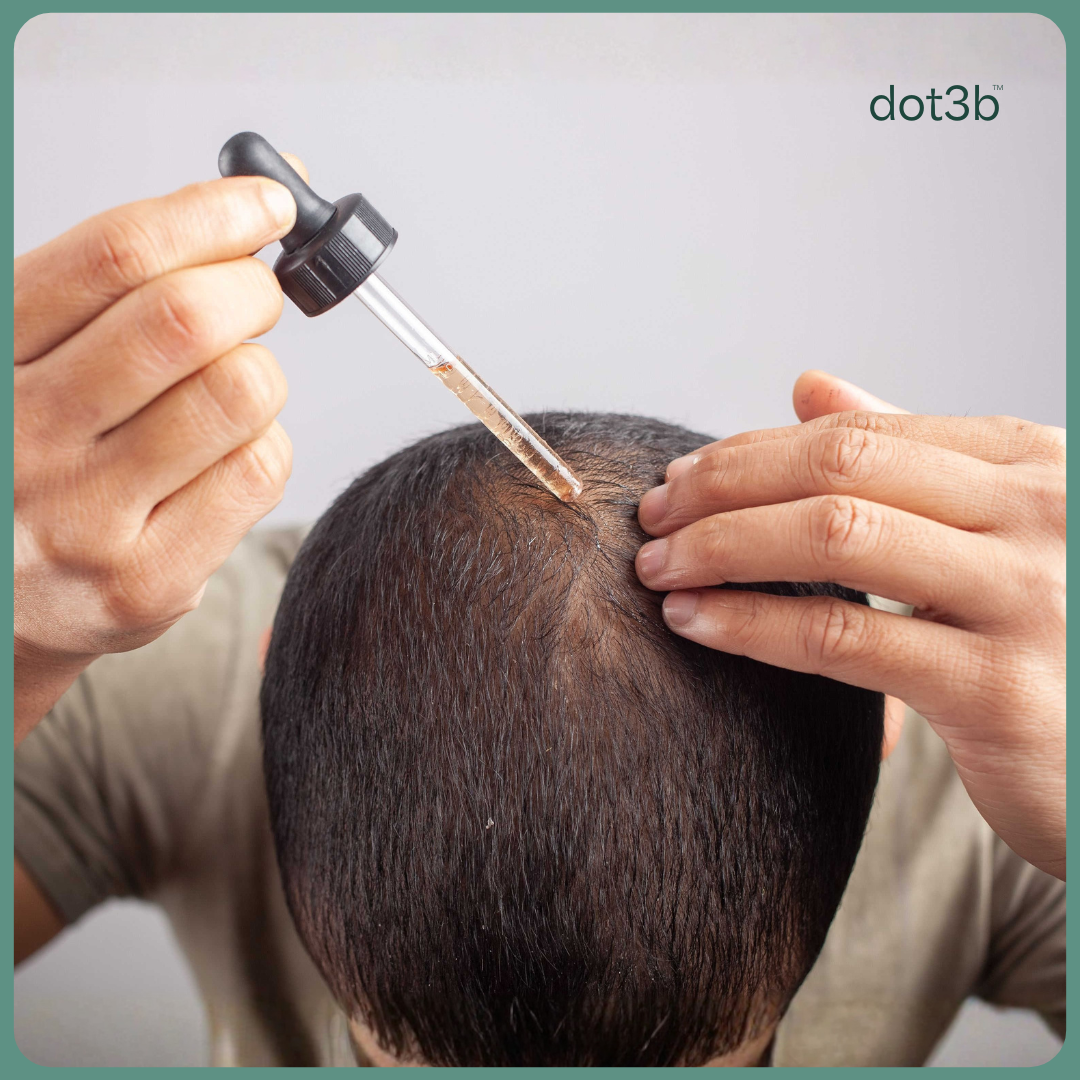 Low-Dose Oral Minoxidil for Hair Loss