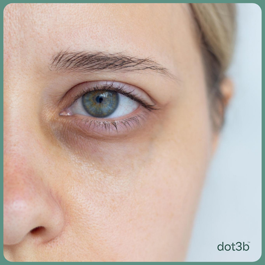 What Does Lack of Sleep Do to Your Skin? The Science Is More Alarming Than You Think