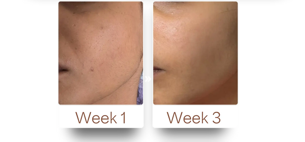 Customer skin progress showing changes from Week 1 to Week 3